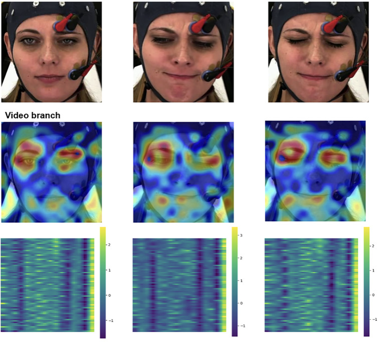 Multimodal Pain Assessment thumbnail
